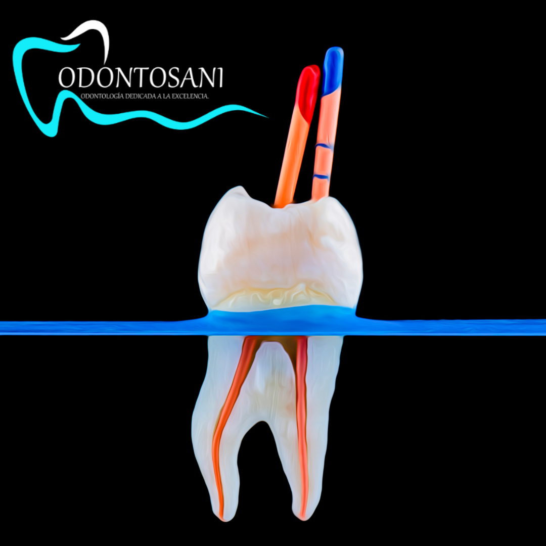 ENDODONCIA