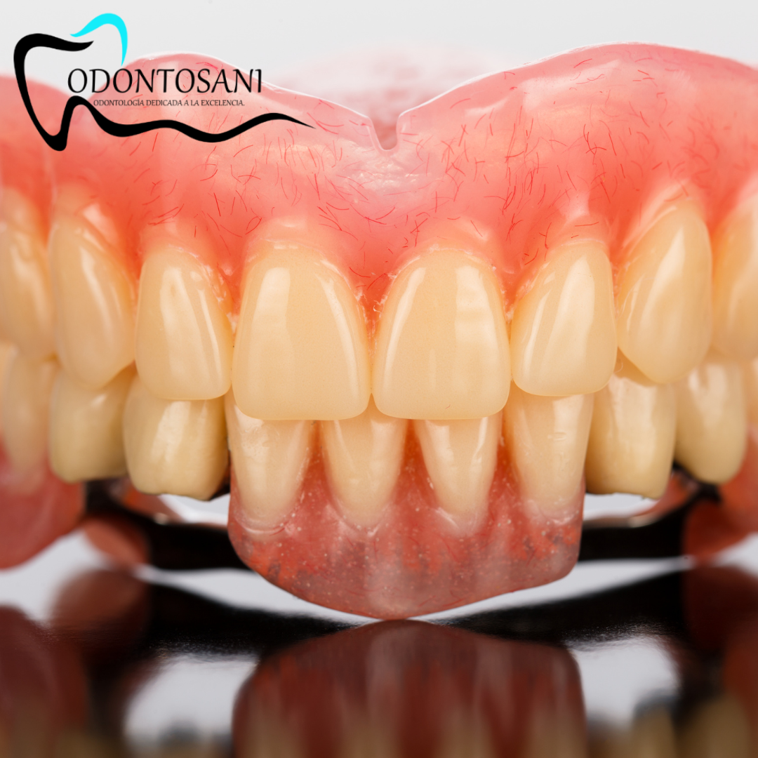 REHABILITACIÓN ORAL
