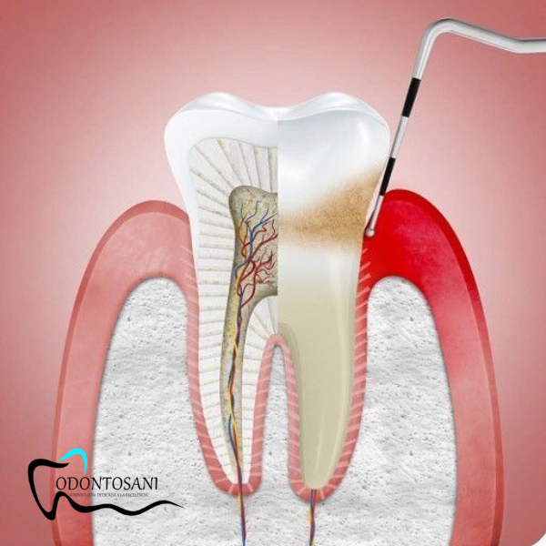 PERIODONCIA