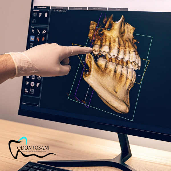 REHABILITACIÓN ORAL
