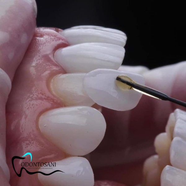 ODONTOLOGÍA ESTÉTICA